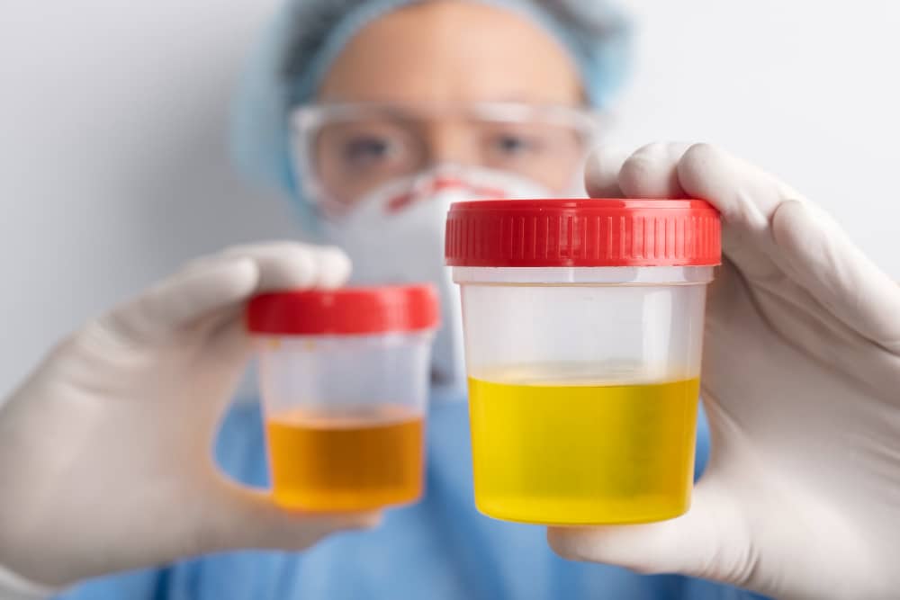 Lab doctor performing medical exam of urine
